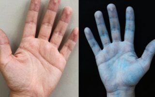 Hand with nerves vs. cold-affected hand